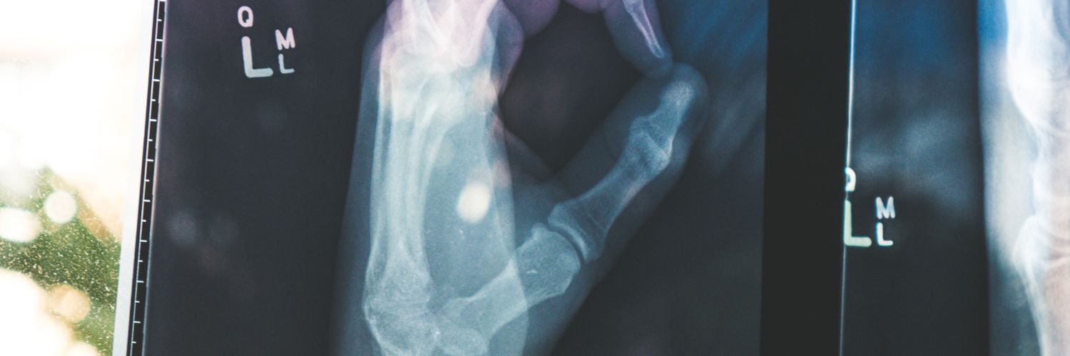 X-ray of a hand and wrist