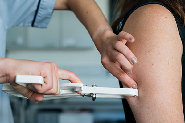Close up of a dietician measuring the fat on an arm with a fat caliper