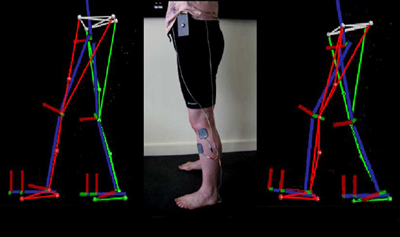 A man wearing electric pads on his legs and animations mimicking his stance