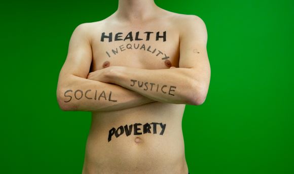 Social justice torso with words written on the skin